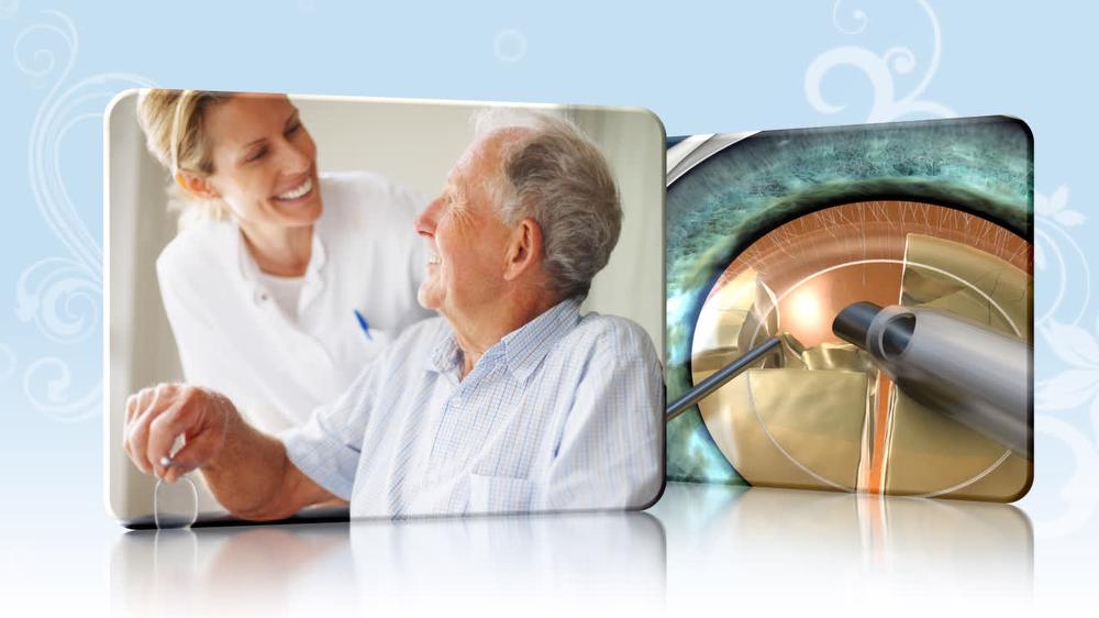 Cataract Surgery: Benefits
